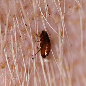 Fleas