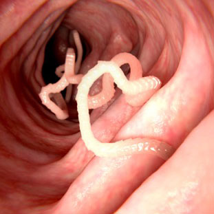 Intestinal worms